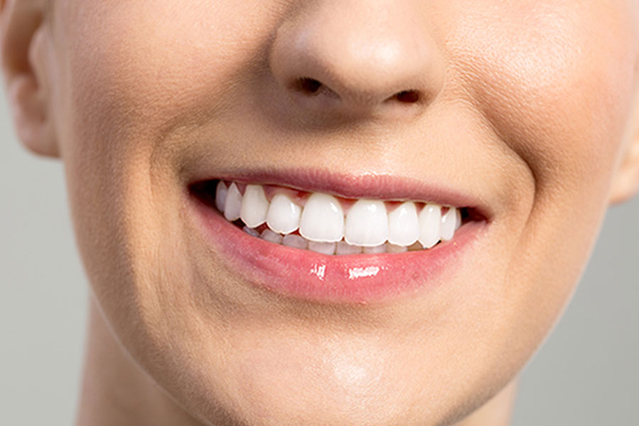 Nevidni zobni aparat je sodobna pot do lepšega nasmeha